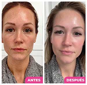 Rejuvenecimiento natural con NAD+ con Resveratrol y Biotina